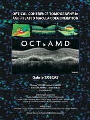 OCT in AMD